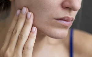 Dry Skin Face 1 1080x675 1